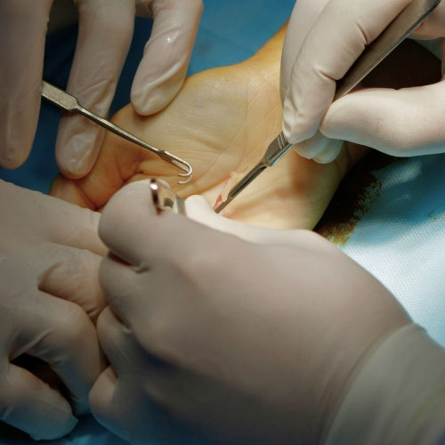 centrauma-cirurgia-da-mao
