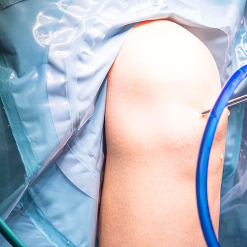 centrauma-cirurgia-do-ombro