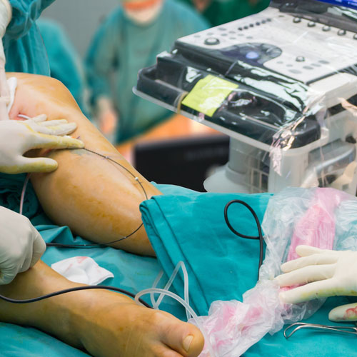 centrauma-cirurgia-pe-tornozelo
