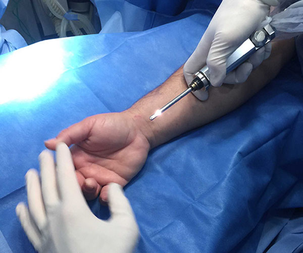 sindrome-do-tunel-do-carpo-rio-de-janeiro-tratamento-3