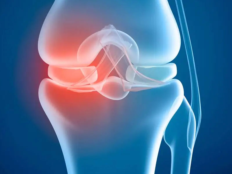 inflitracao-acido-hialuronico-no-joelho-rio-de-janeiro-lesoes-meniscos