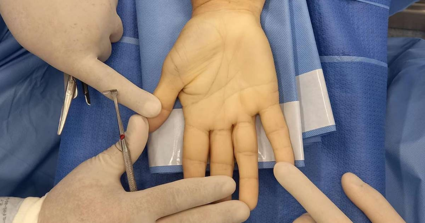 856x449 centrauma cirurgia de mao